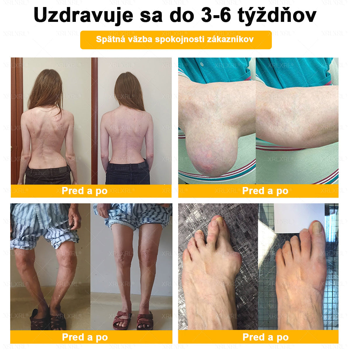 🏥𝑋𝑅𝐿𝑋𝑅𝐿® Krem przeciwbólowy i regenerujący kości z toksyną botulinową i jadem pszczelim 🏆(Specjalnie dla osób starszych, polecany przez EFORT)