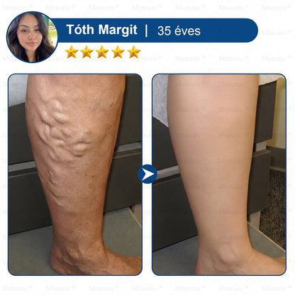 🇸🇰👨‍⚕️✅ Moauou® GHK-Cu™ Mikroihličková regeneračná náplasť ⚡ Okamžitá úľava, dlhotrvajúce výsledky – VEĽKÁ AKCIA!