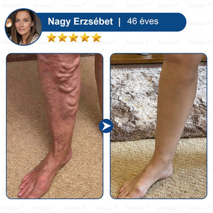 🇸🇰👨‍⚕️✅ Moauou® GHK-Cu™ Mikroihličková regeneračná náplasť ⚡ Okamžitá úľava, dlhotrvajúce výsledky – VEĽKÁ AKCIA!