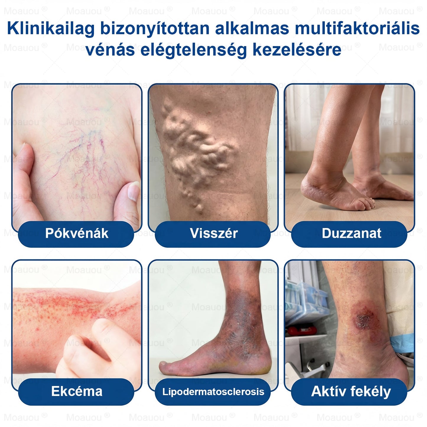 🇸🇰👨‍⚕️✅ Moauou® GHK-Cu™ Mikroihličková regeneračná náplasť ⚡ Okamžitá úľava, dlhotrvajúce výsledky – VEĽKÁ AKCIA!