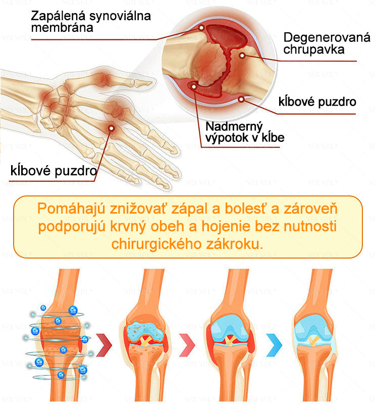 🏥𝑋𝑅𝐿𝑋𝑅𝐿® Krem przeciwbólowy i regenerujący kości z toksyną botulinową i jadem pszczelim 🏆(Specjalnie dla osób starszych, polecany przez EFORT)