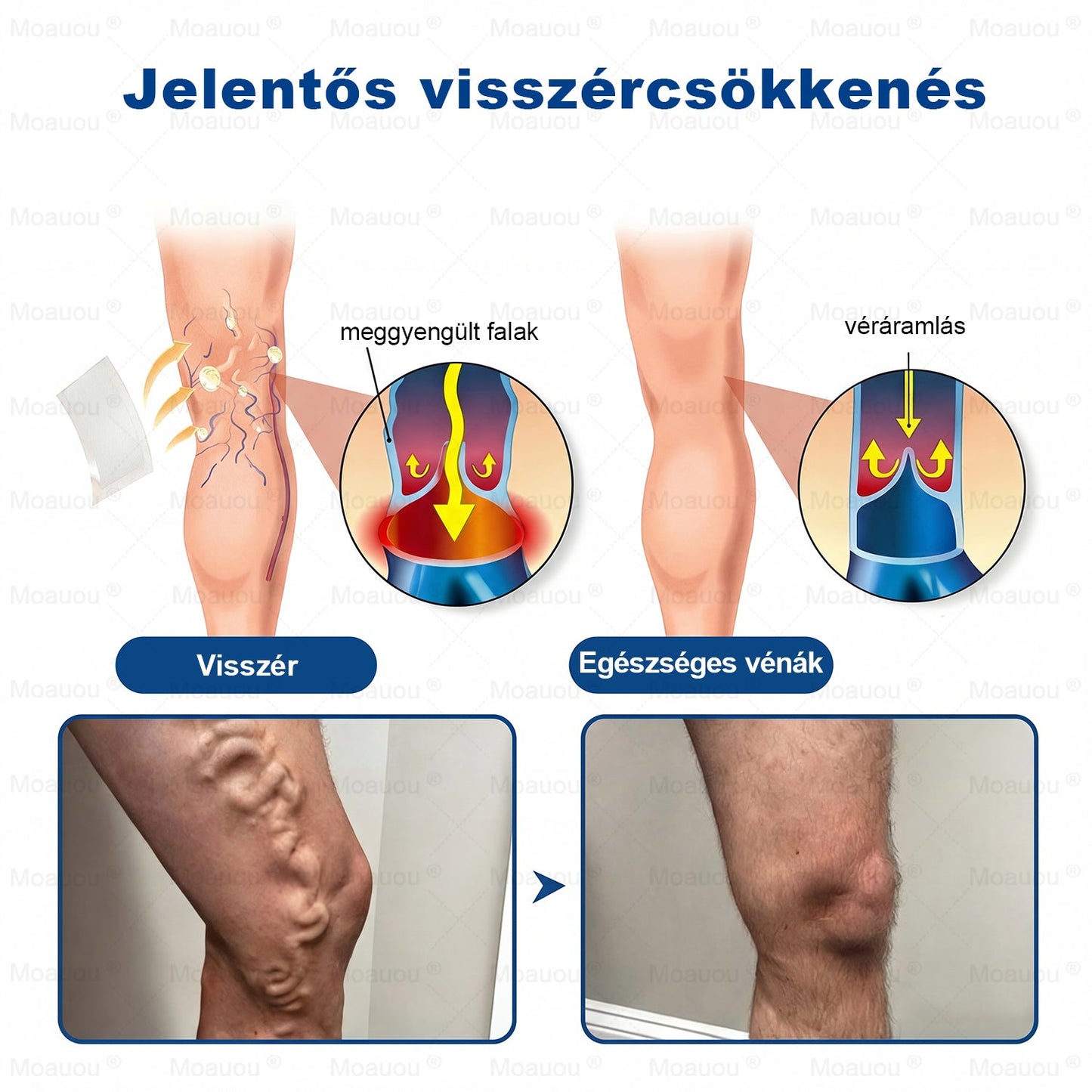 🇸🇰👨‍⚕️✅ Moauou® GHK-Cu™ Mikroihličková regeneračná náplasť ⚡ Okamžitá úľava, dlhotrvajúce výsledky – VEĽKÁ AKCIA!