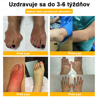 🏥𝑋𝑅𝐿𝑋𝑅𝐿® Krem przeciwbólowy i regenerujący kości z toksyną botulinową i jadem pszczelim 🏆(Specjalnie dla osób starszych, polecany przez EFORT)